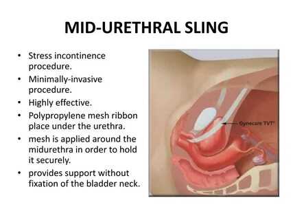 本文深入探讨预支利息的概念、计算方法以及在理财过程中如何避免预支利息带来的额外成本,帮助读者更好地理解和管理个人储蓄和投资的资金流动性。
