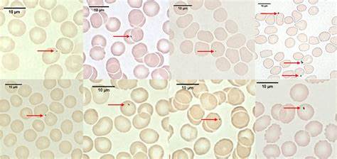 介绍最新研究发现交通相关颗粒物可附着于红细胞并随血液循环分布,解释其检测方法、健康影响、口罩与防护效果,以及个人与公共卫生应对策略和未来研究方向
