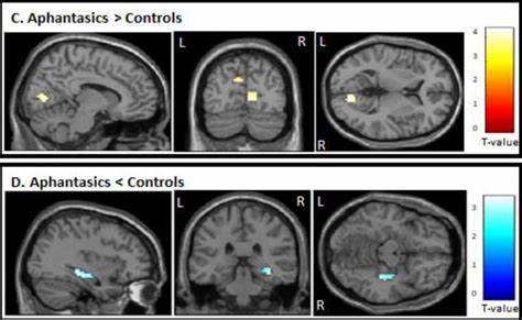 无心像症与迷幻药:当心灵之眼被唤醒的科学与伦理
