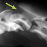 探讨爱尔兰-丹洛综合征(Ehlers-Danlos Syndrome, EDS)犬患者罕见的颈椎不稳定与脱位病例,分析临床表现、诊断方法及治疗策略,为兽医临床提供参考。
