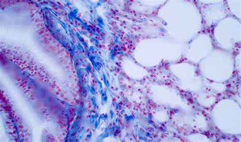 黑尔姆霍兹慕尼黑研究中心与Parse Biosciences联合发布迄今为止规模最大的肺部疾病扰动图谱,利用尖端单细胞测序技术深入解析肺组织细胞反应,为肺部疾病治疗和再生医学提供全新数据基础。该合作将推动人工智能驱动的肺生物学基础研究和靶向疗法的突破。
