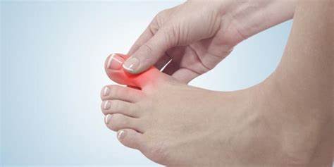 全面介绍脚趾发炎的常见表现、可能病因、如何判断严重程度、临床检查与实验室检查要点、常见的保守治疗与手术选择以及日常预防措施,帮助您判断何时就医并介绍糖尿病等高危人群的特殊处理建议。
