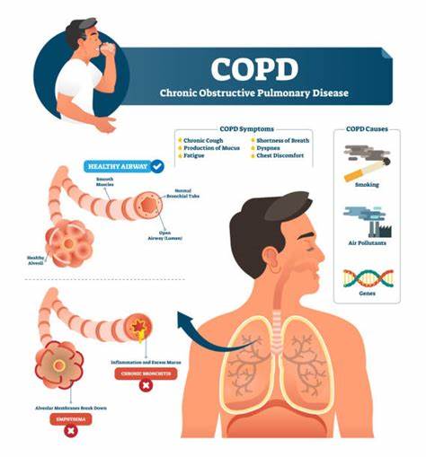 探讨二氧化碳如何在阻塞性肺疾病(COPD)中促进肺部损伤的最新研究进展,揭示该气体在疾病进展中的关键作用,为临床治疗提供新的思路。
