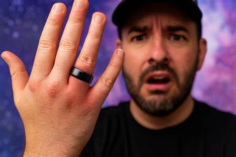 聚焦近期多起Galaxy Ring智能指环电池膨胀并卡住手指的案例,从技术原因、航空与安全影响、用户应急处置、厂商回应与消费者维权角度出发,提供可执行的预防和处理建议,帮助用户在遭遇类似情况时最大程度保障人身安全与合法权益。
