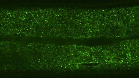 最新研究利用线虫细胞中的荧光颗粒追踪技术,揭示多细胞生物细胞内部远比单细胞生物更加拥挤且高度隔离,这一发现对理解细胞功能、疾病机制及药物传递具有深远意义。
