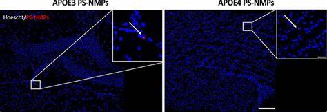 探讨微塑料暴露对携带APOE4基因小鼠阿尔茨海默病发生发展的影响,揭示环境污染与神经退行性疾病之间潜在的联系,促进公众对微塑料危害及遗传因素作用的认识。
