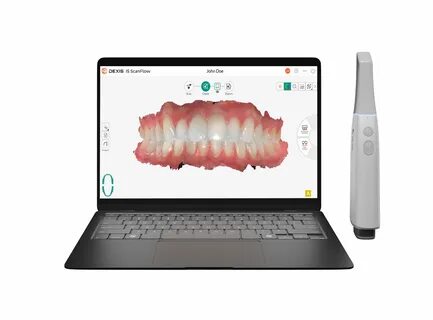 DEXIS全新推出的Imprevo扫描仪,融合先进的IS ScanFlow 2.0软件,凭借卓越的速度、精确度及无线自由,彻底改变数字牙科工作流程。通过深度集成和人工智能驱动的生态系统,这款设备为口腔医疗专业人士带来前所未有的扫描体验和诊疗效率。
