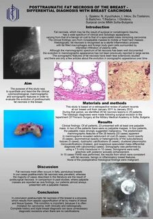 乳房脂肪坏死是一种常见的乳房疾病,了解其成因、症状及治疗方法有助于早期发现和有效管理。本文详细解析脂肪坏死的相关知识,帮助读者保持乳房健康。
