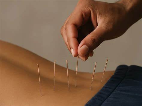 探讨针灸作为一种传统中医疗法在缓解老年人慢性腰痛方面的作用及其科学依据,分析其疗效、安全性及应用前景。
