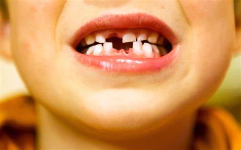 深入探讨儿童牙齿摇摆期的生理变化、护理方法及心理影响,帮助家长科学应对儿童换牙过程中遇到的各种问题,促进牙齿健康成长。
