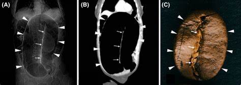 深入探讨利用先进的CT扫描技术发现意式浓缩咖啡内部缺陷,揭示影响口感和品质的关键因素,助力咖啡爱好者和专业人士打造更优质的咖啡体验。
