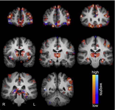 探讨利用多模态磁共振成像数据识别并解析人类大脑性别差异的研究方法、关键发现、技术挑战与伦理影响,为神经影像学和精准医学提供可操作的视角与未来方向
