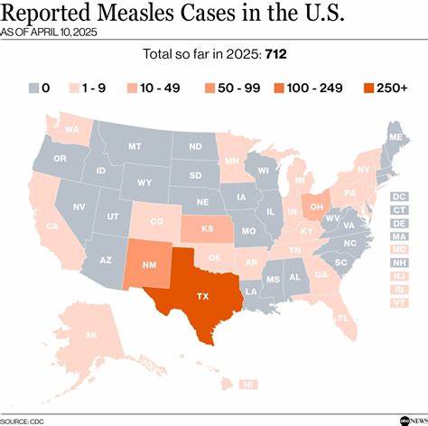 美国麻疹病例激增至733例,CDC发布最新警示与防控建议
