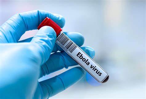 美国疾病控制与预防中心(CDC)近日宣布一名美国公民感染埃博拉病毒,引发全球关注。本文深入分析病毒传播机制、防控措施及公众应对策略,助力读者全面了解埃博拉病毒的最新动态与防护知识。
