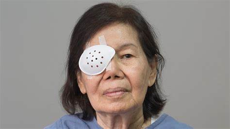 白内障手术是解决视力模糊的重要手段,术后科学护理对于确保手术成功与长期视力稳定至关重要。从手术当天起的注意事项到恢复期的生活调整,都需要患者严格遵循医疗建议以杜绝并发症,促进眼睛健康快速恢复。本文详细解析白内障手术后应注意的各种细节,助您安全顺利度过康复期。
