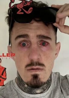 探讨UFC重量级冠军汤姆·阿斯皮纳尔因眼部严重受伤可能面临的职业危机,分析其康复进展、格斗界的反应以及对MMA运动的深远影响。

