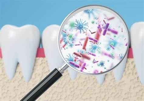 解读最新大型队列研究如何将口腔中的细菌与真菌群与胰腺癌发生相关联,解析可能的生物学机制、临床意义与预防建议,帮助读者理解口腔健康与系统性癌症之间的潜在联系。
