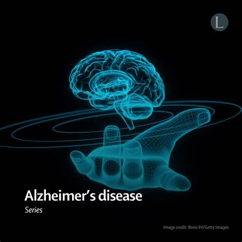 阿尔茨海默病作为全球日益严峻的公共健康挑战,《柳叶刀》系列报告系统地揭示了病因、诊断、治疗及预防的最新进展,推动了科学界和医疗界对该疾病的全面认识及应对策略。本文深度解读该系列成果,导引未来研究与临床实践方向。
