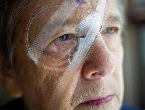 深入了解白内障手术后的恢复过程,掌握科学的康复方法和注意事项,助您顺利恢复视力,重获清晰明亮的视觉体验。通过专业建议和实际案例分享,让每一位患者都能安心康复,避免并发症,提升生活质量。
