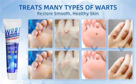 在快速发展的科技时代,选择合适且可维护的技术成为软件开发的核心挑战。探讨为何带有"瑕疵"(warts)的技术反而更有利于长远维护和兼容性,如何利用这些特点构建更健壮的系统,以及从SQLite等实际案例中汲取的经验教训。
