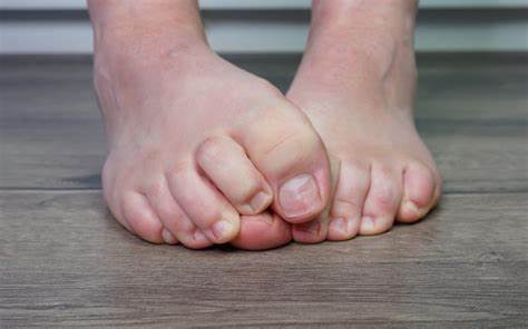 详尽介绍脚趾发炎的常见原因、症状识别、家庭急救与专业治疗方法,包含伤口清洁、消毒、包扎与预防建议,特别提示糖尿病等高风险人群的注意事项和何时就医的警示信息。
