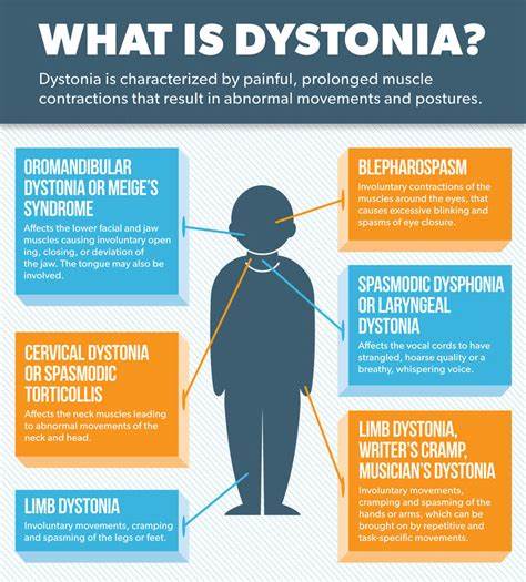 肌张力障碍是一种复杂的神经系统运动障碍,表现为肌肉的不自主收缩,导致扭曲的动作和异常姿势。本文全面解析肌张力障碍的分类、病因、临床表现及多样化治疗方案,帮助读者更好地认识和应对这一疾病。
